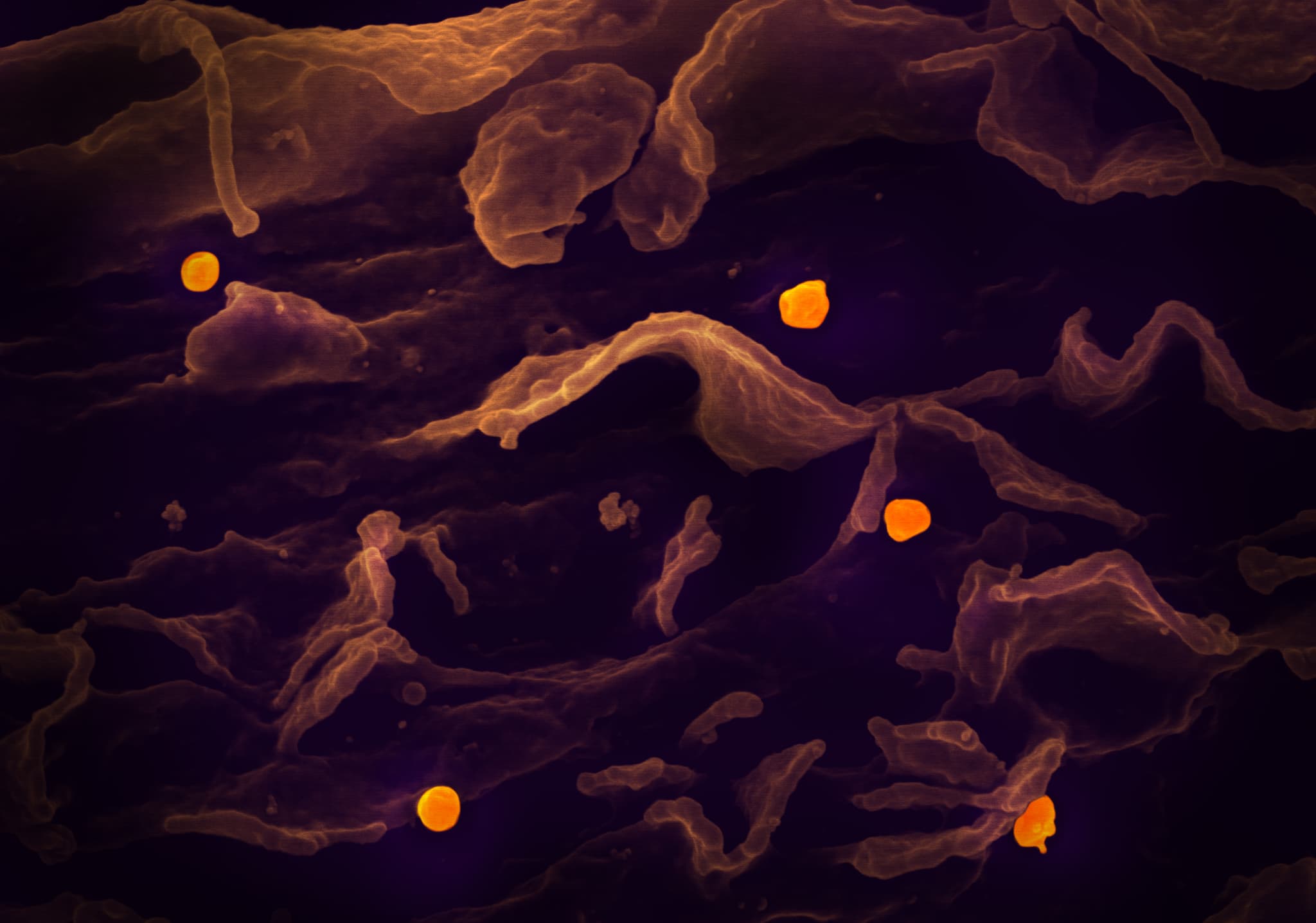 It's Not a Rumor Anymore